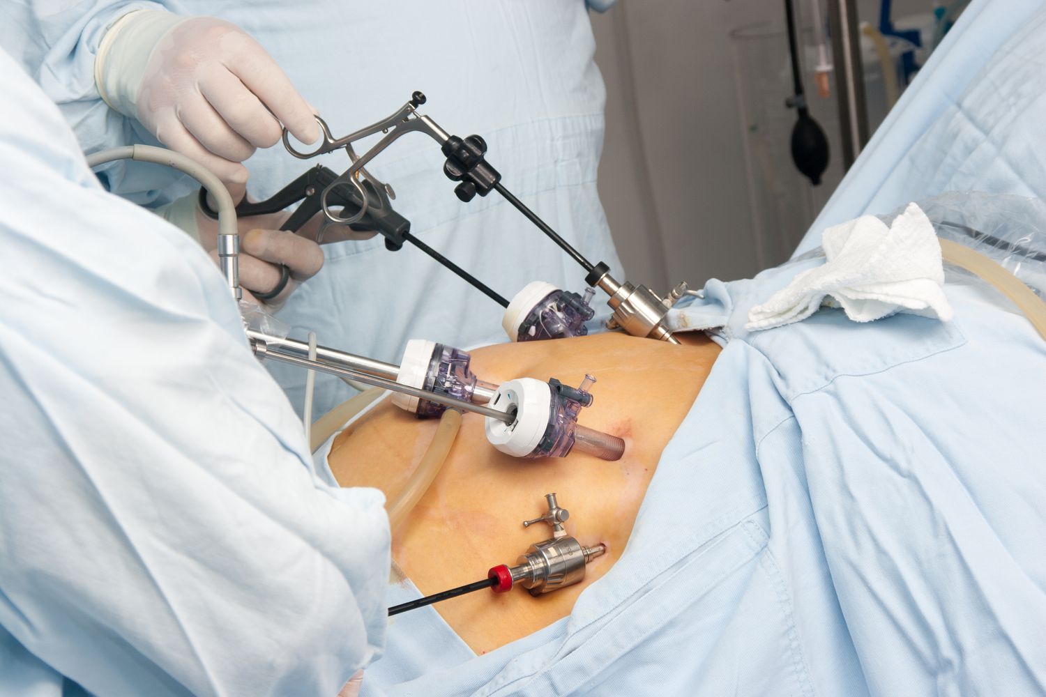 Bariatric Surgery Abu Dhabi