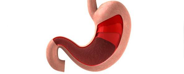 Gastric Banding Abu Dhabi