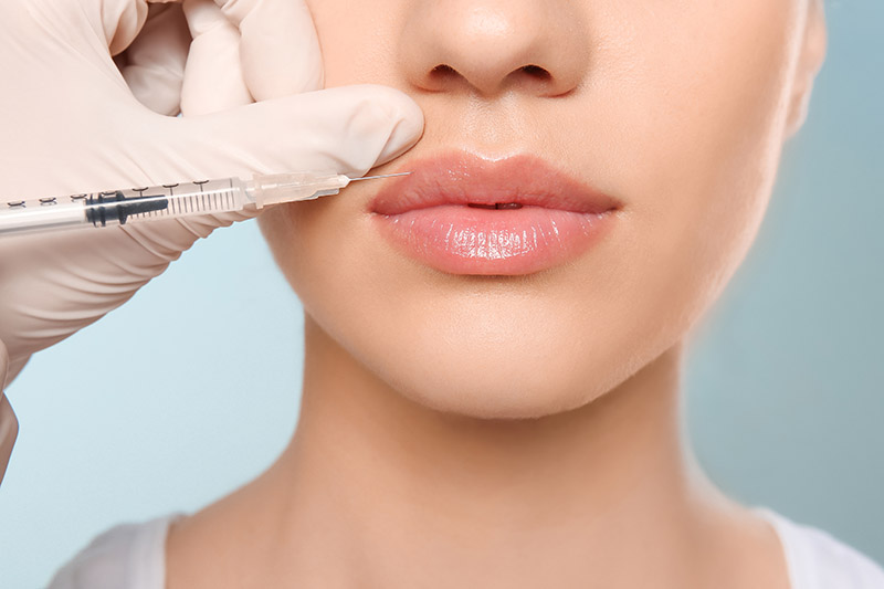 Lip Fillers Injections