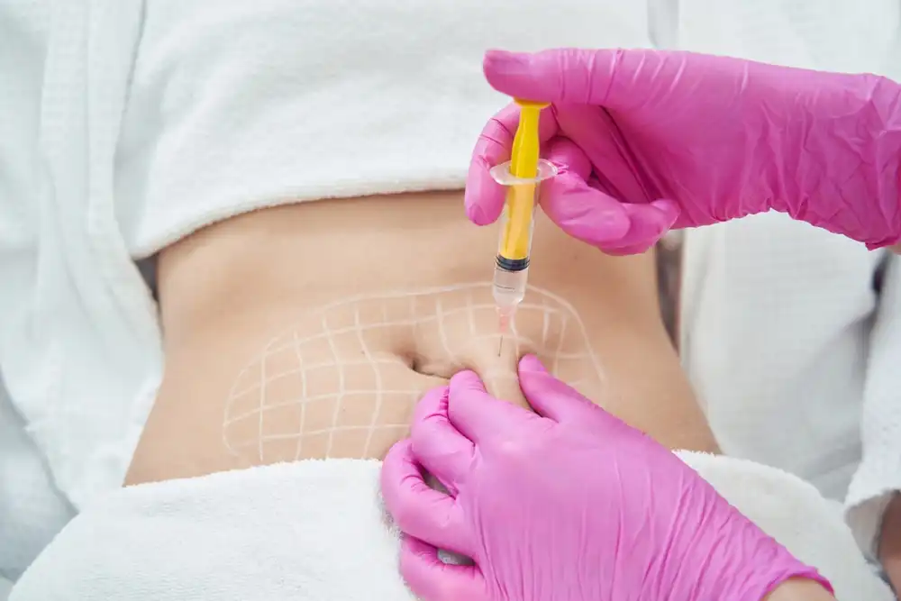 Lipolysis Treatment Abu Dhabi - Sydney Royal Aesthetics